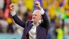 أرنولد يحسم مشاركة 4 لاعبين غابوا عن تشكيلات كاساس