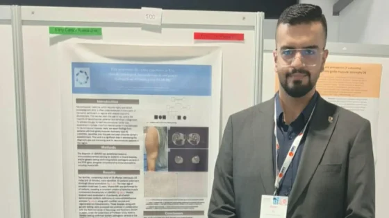 تخصص نادر.. أمل جديد لمرضى الأعصاب في العراق