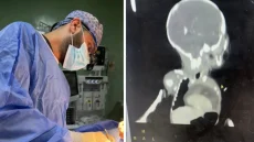 لم يُسجل منها سوى 22 حالة بالعالم..  نجاح أول عملية نادرة لطفلة حديثة الولادة بالعراق